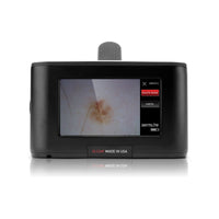 DermLite Dermatoscope Cam