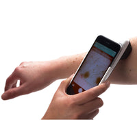 DermLite Dermatoscope HUD Patient Dermatoscope
